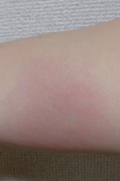 インフルエンザの予防接種が始まっています 信州メディビトネット